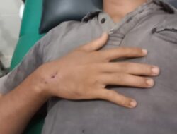 Diduga Security PT. MAL Aniaya Warga Hingga Terluka